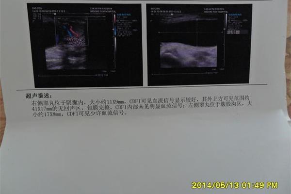 狗狗下载,狗狗搜索mkv下载